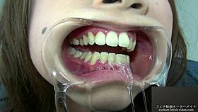 Teeth Fetish Exploration with Unique Saliva Play Today