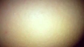 Neighbor boasts, 'Look at my huge torn vagina!'