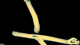 Foster, you gotta learn manners the hard way, got it?