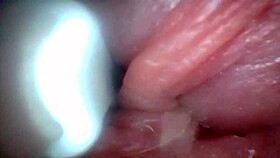 Penis Sensitivity Exposed Emotionally